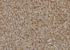PSMC6 Antibody - 1:100 staining mouse liver tissue by IHC-P. The sample was formaldehyde fixed and a heat mediated antigen retrieval step in citrate buffer was performed. The sample was then blocked and incubated with the antibody for 1.5 hours at 22°C. An HRP conjugated goat anti-rabbit antibody was used as the secondary.