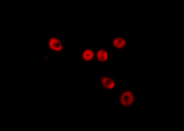 PSMC6 Antibody - Staining HepG2 cells by IF/ICC. The samples were fixed with PFA and permeabilized in 0.1% Triton X-100, then blocked in 10% serum for 45 min at 25°C. The primary antibody was diluted at 1:200 and incubated with the sample for 1 hour at 37°C. An Alexa Fluor 594 conjugated goat anti-rabbit IgG (H+L) antibody, diluted at 1/600, was used as secondary antibody.