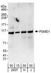 PSMD1 Antibody - Detection of Human PSMD1 by Western Blot. Samples: Whole cell lysate from 293T (15 and 50 ug), HeLa (H; 50 ug), and Jurkat (J; 50 ug) cells. Antibodies: Affinity purified rabbit anti-PSMD1 antibody used for WB at 0.1 ug/ml. Detection: Chemiluminescence with an exposure time of 3 minutes.