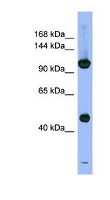 PSMD1 Antibody - PSMD1 antibody Western blot of Fetal Stomach lysate. This image was taken for the unconjugated form of this product. Other forms have not been tested.