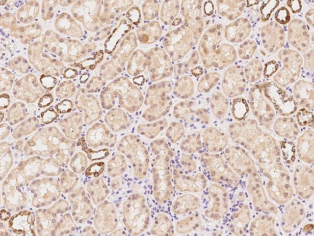 PSMD1 Antibody - Immunochemical staining of human PSMD1 in human kidney with rabbit polyclonal antibody at 1:100 dilution, formalin-fixed paraffin embedded sections.