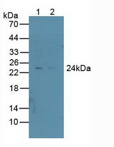 PSMD10 / Gankyrin Antibody - Western Blot; Sample: Lane1: Human A549 Cells; Lane2: Human HepG2 Cells.