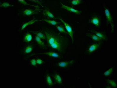 PSMD10 / Gankyrin Antibody - Immunofluorescence staining of Hela cells with Rabbit anti-human 26S proteasome non-ATPase regulatory subunit 10 polyclonal Antibody(PSMD10) at 1:200, counter-stained with DAPI. The cells were fixed in 4% formaldehyde, permeabilized using 0.2% Triton X-100 and blocked in 10% normal Goat Serum. The cells were then incubated with the antibody overnight at 4°C. The secondary antibody was Alexa Fluor 488-congugated AffiniPure Goat Anti-Rabbit IgG(H+L).