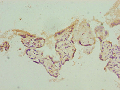 PSMD10 / Gankyrin Antibody - Immunohistochemistry of paraffin-embedded human placenta tissue using Rabbit anti-human 26S proteasome non-ATPase regulatory subunit 10 polyclonal Antibody(PSMD10) at dilution of 1:100