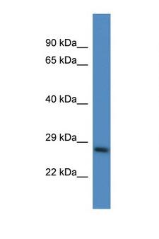 PSMD10 / Gankyrin Antibody - PSMD10 antibody Western blot of Mouse Liver lysate. Antibody concentration 1 ug/ml. This image was taken for the unconjugated form of this product. Other forms have not been tested.