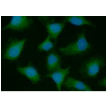 PSMD10 / Gankyrin Antibody - ICC/IF analysis of PSMD10 in A549 cells line, stained with DAPI (Blue) for nucleus staining and monoclonal anti-human PSMD10 antibody (1:100) with goat anti-mouse IgG-Alexa fluor 488 conjugate (Green).