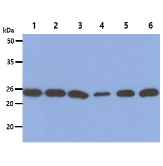 PSMD10 / Gankyrin Antibody - The Cell lysates (40ug) were resolved by SDS-PAGE, transferred to PVDF membrane and probed with anti-human PSMD10 antibody (1:1000). Proteins were visualized using a goat anti-mouse secondary antibody conjugated to HRP and an ECL detection system. Lane 1. : A549 cell lysate Lane 2. : PC3 cell lysate Lane 3. : K562 cell lysate Lane 4. : HepG2 cell lysate Lane 5. : HeLa cell lysate Lane 6. : Jurkat cell lysate