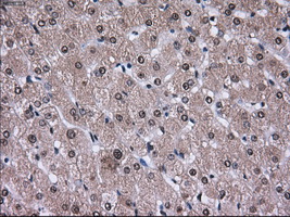 PSMD10 / Gankyrin Antibody - IHC of paraffin-embedded liver tissue using anti-PSMD10 mouse monoclonal antibody. (Dilution 1:50).