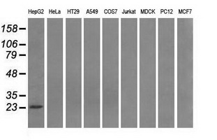 PSMD10 / Gankyrin Antibody - Western blot of extracts (35 ug) from 9 different cell lines by using anti-PSMD10 monoclonal antibody.