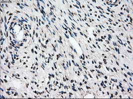 PSMD10 / Gankyrin Antibody - IHC of paraffin-embedded Ovary tissue using anti-PSMD10 mouse monoclonal antibody. (Dilution 1:50).