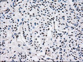 PSMD10 / Gankyrin Antibody - IHC of paraffin-embedded endometrium tissue using anti-PSMD10 mouse monoclonal antibody. (Dilution 1:50).