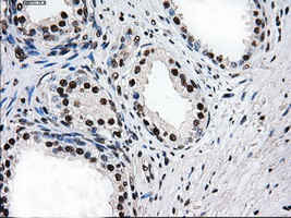 PSMD10 / Gankyrin Antibody - IHC of paraffin-embedded prostate tissue using anti-PSMD10 mouse monoclonal antibody. (Dilution 1:50).