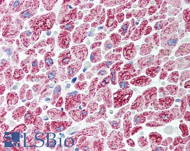 PSMD10 / Gankyrin Antibody - Human Heart (formalin-fixed, paraffin-embedded) stained with PSMD10 antibody LS-B300 at 5 ug/ml followed by biotinylated goat anti-rabbit IgG secondary antibody, alkaline phosphatase-streptavidin and chromogen.  This image was taken for the unconjugated form of this product. Other forms have not been tested.