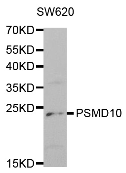 PSMD10 / Gankyrin Antibody - Western blot analysis of extracts of SW620 cell lines.