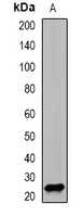 PSMD10 / Gankyrin Antibody - Western blot analysis of PSMD10 expression in SW620 (A) whole cell lysates.