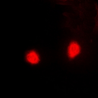 PSMD10 / Gankyrin Antibody - Immunofluorescent analysis of PSMD10 staining in HeLa cells. Formalin-fixed cells were permeabilized with 0.1% Triton X-100 in TBS for 5-10 minutes and blocked with 3% BSA-PBS for 30 minutes at room temperature. Cells were probed with the primary antibody in 3% BSA-PBS and incubated overnight at 4 deg C in a humidified chamber. Cells were washed with PBST and incubated with a DyLight 594-conjugated secondary antibody (red) in PBS at room temperature in the dark.