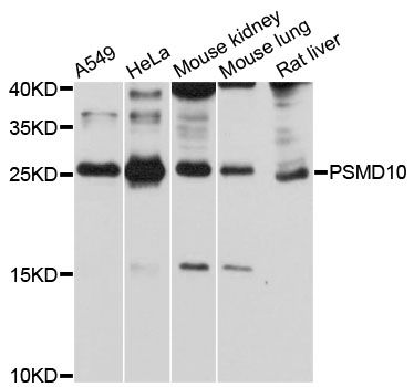 PSMD10 / Gankyrin Antibody - Western blot analysis of extracts of various cell lines, using PSMD10 antibody at 1:1000 dilution. The secondary antibody used was an HRP Goat Anti-Rabbit IgG (H+L) at 1:10000 dilution. Lysates were loaded 25ug per lane and 3% nonfat dry milk in TBST was used for blocking. An ECL Kit was used for detection and the exposure time was 10s.