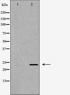 PSMD10 / Gankyrin Antibody - Western blot analysis of HeLa cell lysates using PSMD10 antibody. The lane on the left is treated with the antigen-specific peptide.