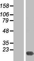 PSMD10 / Gankyrin Protein - Western validation with an anti-DDK antibody * L: Control HEK293 lysate R: Over-expression lysate