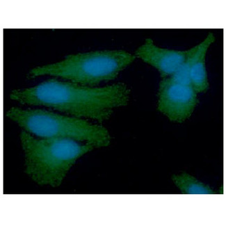 PSMD11 Antibody - ICC/IF analysis of PSMD11 in HeLa cells line, stained with DAPI (Blue) for nucleus staining and monoclonal anti-human PSMD11 antibody (1:100) with goat anti-mouse IgG-Alexa fluor 488 conjugate (Green).