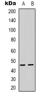 PSMD11 Antibody - Western blot analysis of PSMD11 expression in HeLa (A); HEK293T (B) whole cell lysates.