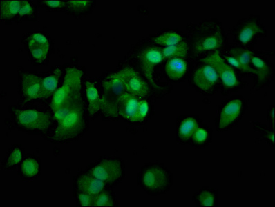 PSMD11 Antibody - Immunofluorescence staining of MCF-7 cells with PSMD11 Antibody at 1:100, counter-stained with DAPI. The cells were fixed in 4% formaldehyde, permeabilized using 0.2% Triton X-100 and blocked in 10% normal Goat Serum. The cells were then incubated with the antibody overnight at 4°C. The secondary antibody was Alexa Fluor 488-congugated AffiniPure Goat Anti-Rabbit IgG(H+L).
