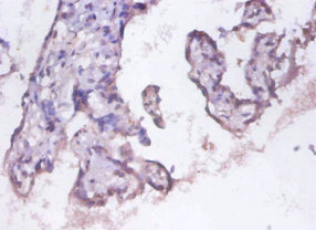 PSMD11 Antibody - Immunohistochemistry of paraffin-embedded human placenta tissue using PSMD11 Antibody at dilution of 1:100