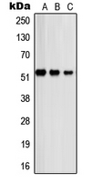 PSMD12 / Rpn5 Antibody - Western blot analysis of PSMD12 expression in A431 (A); COLO320 (B); HeLa (C) whole cell lysates.