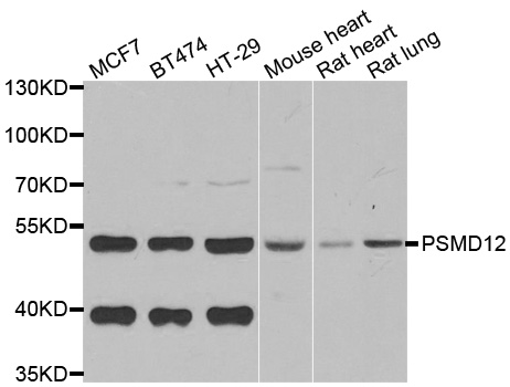 PSMD12 / Rpn5 Antibody - Western blot analysis of extracts of various cell lines.