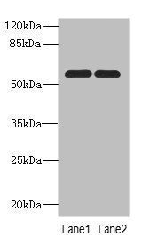 PSMD12 / Rpn5 Antibody - Western blot All Lanes: PSMD12antibody at 0.93ug/ml Lane 1 : U87 whole cell lysate Lane 2 : Hela whole cell lysate Secondary Goat polyclonal to Rabbit IgG at 1/10000 dilution Predicted band size: 53,51 kDa Observed band size: 53 kDa
