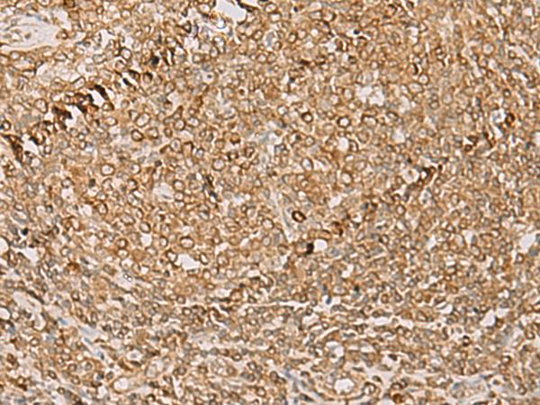 PSMD12 / Rpn5 Antibody - Immunohistochemistry of paraffin-embedded Human tonsil tissue  using PSMD12 Polyclonal Antibody at dilution of 1:50(×200)