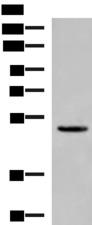 PSMD12 / Rpn5 Antibody - Western blot analysis of Human cerebrum tissue lysate  using PSMD12 Polyclonal Antibody at dilution of 1:900