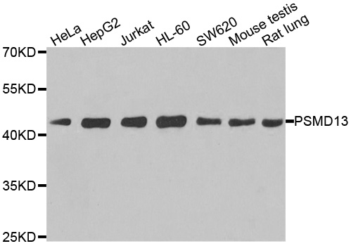 PSMD13 Antibody - Western blot analysis of extracts of various cell lines.