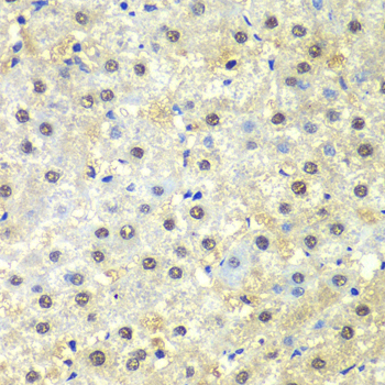 PSMD13 Antibody - Immunohistochemistry of paraffin-embedded human liver injury tissue.