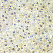 PSMD13 Antibody - Immunohistochemistry of paraffin-embedded human liver injury tissue.