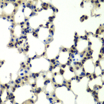 PSMD13 Antibody - Immunohistochemistry of paraffin-embedded mouse lung tissue.