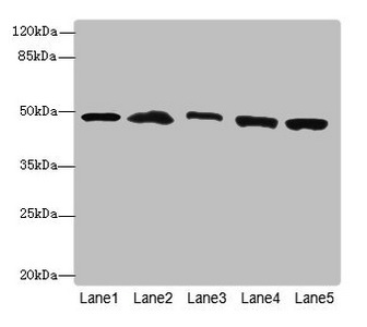 PSMD13 Antibody - Western blot All Lanes: PSMD13antibody at 3.42ug/ml Lane 1 : Mouse lung tissue Lane 2 : 293T whole cell lysate Lane 3 : Hela whole cell lysate Lane 4 : HepG-2 whole cell lysate Lane 5 : Jurkat whole cell lysate Secondary Goat polyclonal to Rabbit IgG at 1/10000 dilution Predicted band size: 43 kDa Observed band size: 43 kDa