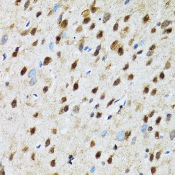 PSMD13 Antibody - Immunohistochemistry of paraffin-embedded rat brain using PSMD13 antibody at dilution of 1:100 (40x lens).