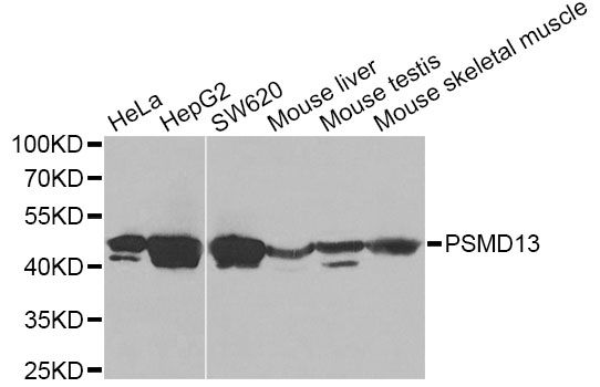 PSMD13 Antibody - Western blot analysis of extracts of various cell lines, using PSMD13 Antibody at 1:1000 dilution. The secondary antibody used was an HRP Goat Anti-Rabbit IgG (H+L) at 1:10000 dilution. Lysates were loaded 25ug per lane and 3% nonfat dry milk in TBST was used for blocking. An ECL Kit was used for detection and the exposure time was 120s.