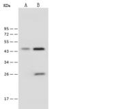 PSMD13 Antibody - Anti-PSMD13 rabbit polyclonal antibody at 1:500 dilution. Lane A: 293T Whole Cell Lysate. Lane B: HeLa Whole Cell Lysate. Lysates/proteins at 30 ug per lane. Secondary: Goat Anti-Rabbit IgG (H+L)/HRP at 1/10000 dilution. Developed using the ECL technique. Performed under reducing conditions. Predicted band size: 43 kDa. Observed band size: 45 kDa.