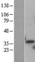 PSMD14 Protein - Western validation with an anti-DDK antibody * L: Control HEK293 lysate R: Over-expression lysate