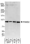 PSMD2 Antibody - Detection of Human PSMD2 by Western Blot. Samples: Whole cell lysate from 293T (15 and 50 ug), HeLa (H; 50 ug) and Jurkat (J; 50 ug) cells. Antibodies: Affinity purified rabbit anti-PSMD2 antibody used for WB at 0.4 ug/ml. Detection: Chemiluminescence with an exposure time of 30 seconds.