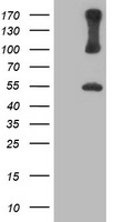 PSMD2 Antibody - HEK293T cells were transfected with the pCMV6-ENTRY control (Left lane) or pCMV6-ENTRY PSMD2 (Right lane) cDNA for 48 hrs and lysed. Equivalent amounts of cell lysates (5 ug per lane) were separated by SDS-PAGE and immunoblotted with anti-PSMD2.