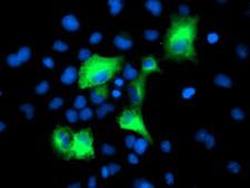 PSMD2 Antibody - Anti-PSMD2 mouse monoclonal antibody immunofluorescent staining of COS7 cells transiently transfected by pCMV6-ENTRY PSMD2.