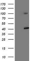 PSMD2 Antibody - HEK293T cells were transfected with the pCMV6-ENTRY control (Left lane) or pCMV6-ENTRY PSMD2 (Right lane) cDNA for 48 hrs and lysed. Equivalent amounts of cell lysates (5 ug per lane) were separated by SDS-PAGE and immunoblotted with anti-PSMD2.