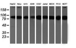 PSMD2 Antibody - Western blot of extracts (35 ug) from 9 different cell lines by using anti-PSMD2 monoclonal antibody.