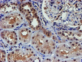PSMD2 Antibody - IHC of paraffin-embedded Human Kidney tissue using anti-PSMD2 mouse monoclonal antibody.