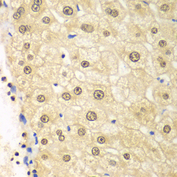 PSMD2 Antibody - Immunohistochemistry of paraffin-embedded human liver injury tissue.