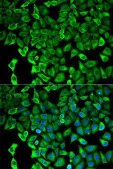 PSMD2 Antibody - Immunofluorescence analysis of HeLa cells.