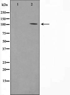 PSMD2 Antibody - Western blot analysis on COLO205 cell lysates using PSMD2 antibody. The lane on the left is treated with the antigen-specific peptide.